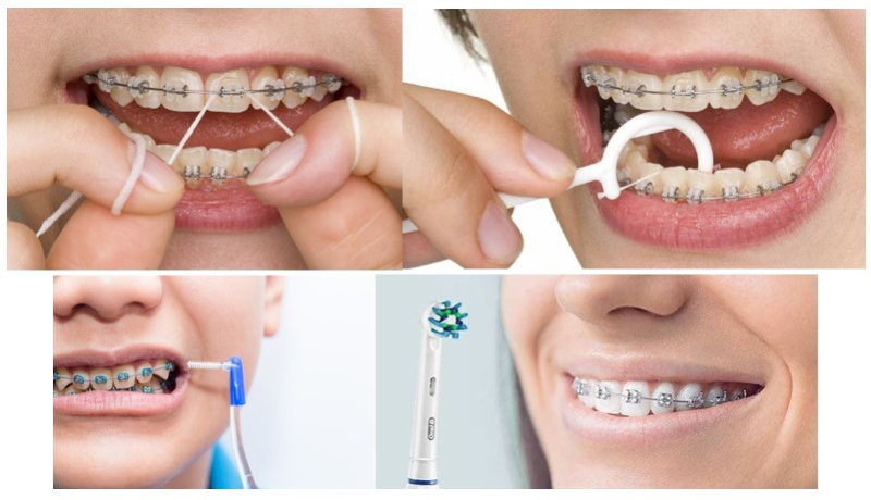 مرحله بحث و تبادل نظر در مورد مراقبت از دهان و دندان