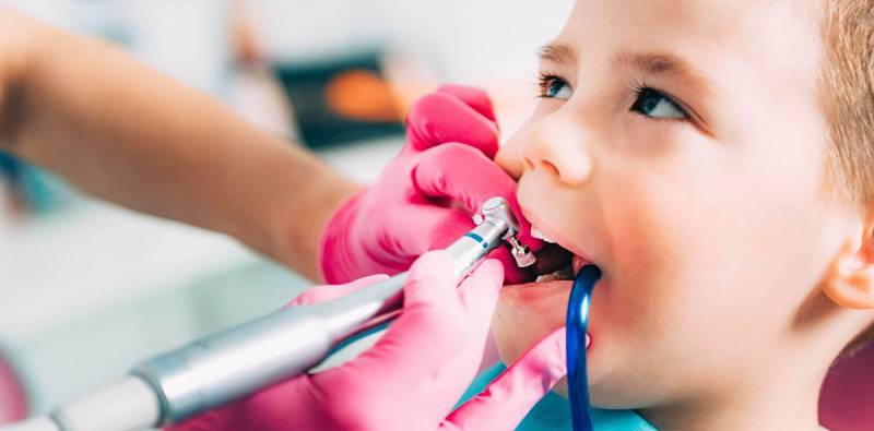 فلوراید تراپی دندان کودکان