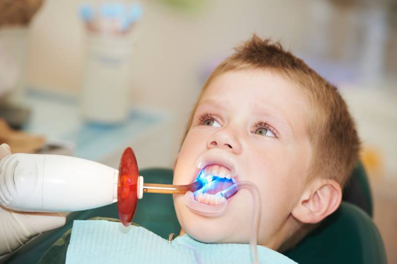 فیشور سیلانت دندان کودکان