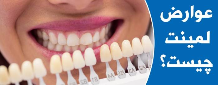 عوارض لمینت دندان چیست؟