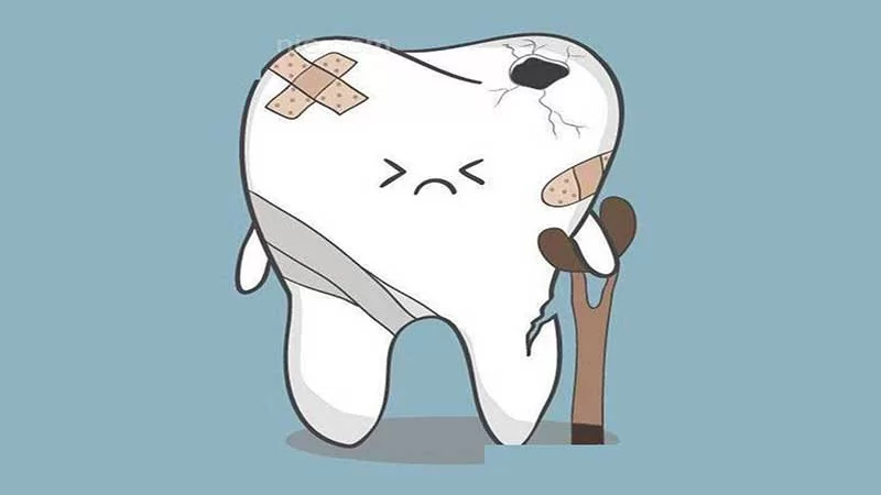 ترومای دندان 