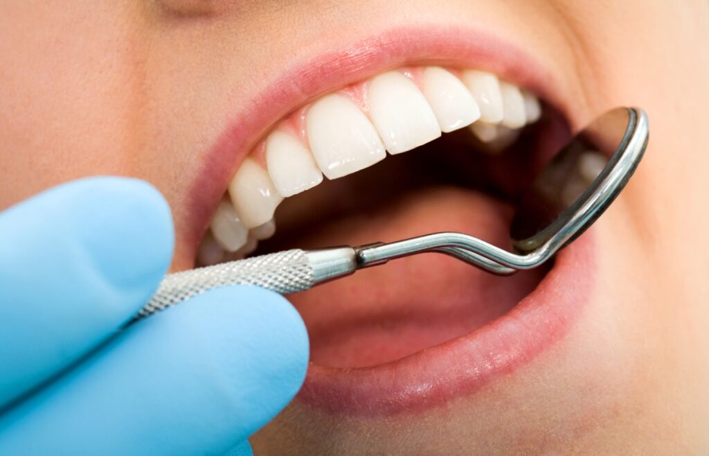 خمیردندان و نخ دندان مناسب کامپوزیت 