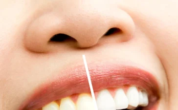Dental brosage