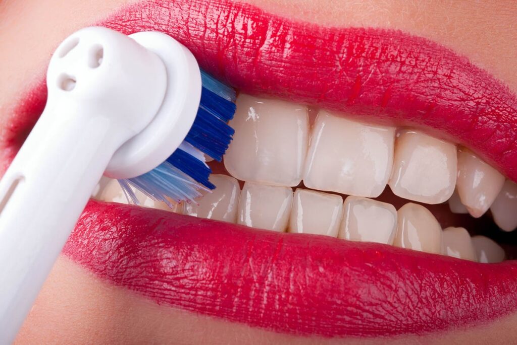 مراقبت‌های پس از بروساژ دندان