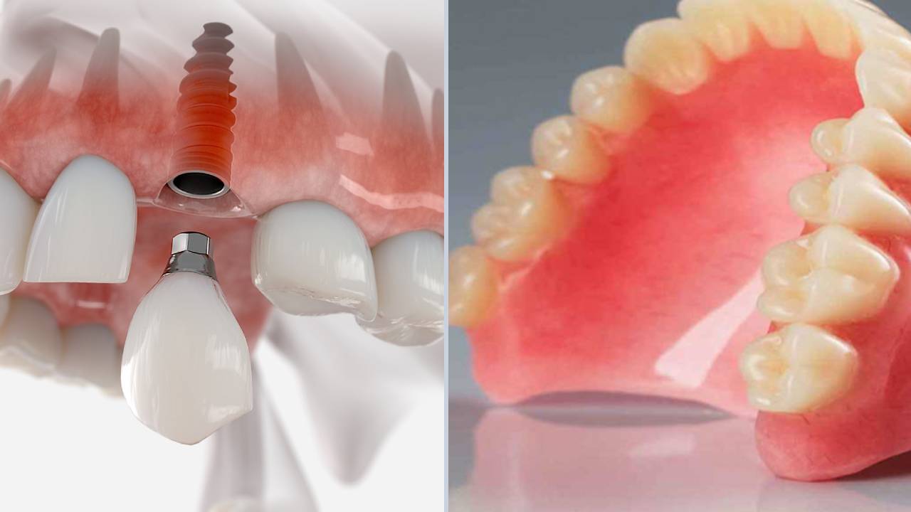 دندان مصنوعی! یک مشکل رایج میان سالمندان با وجود راه حل بهتر - خبرخوان تی شین