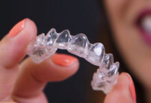 ارتودنسی نامرئی یا شفاف؛ مناسب چه افرادی است؟