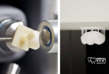 فناوری جدید در ساخت ترمیم های زیرکونیای چاپ سه بعدی در همان روز