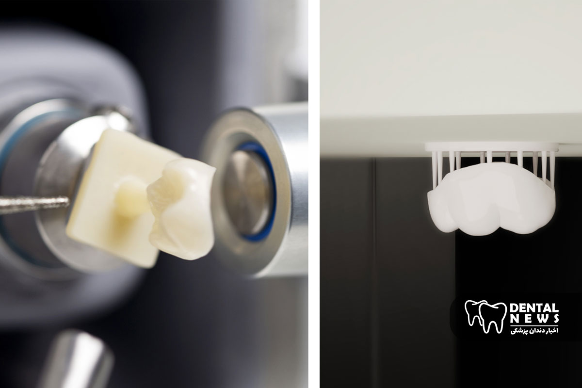 فناوری جدید در ساخت ترمیم های زیرکونیای چاپ سه بعدی در همان روز