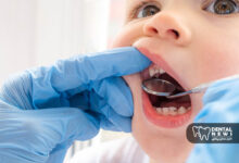 چرا دندان های شیری کودکان باید درمان شوند؟ پاسخ به یک دغدغه والدین