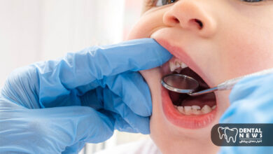 چرا دندان های شیری کودکان باید درمان شوند؟ پاسخ به یک دغدغه والدین