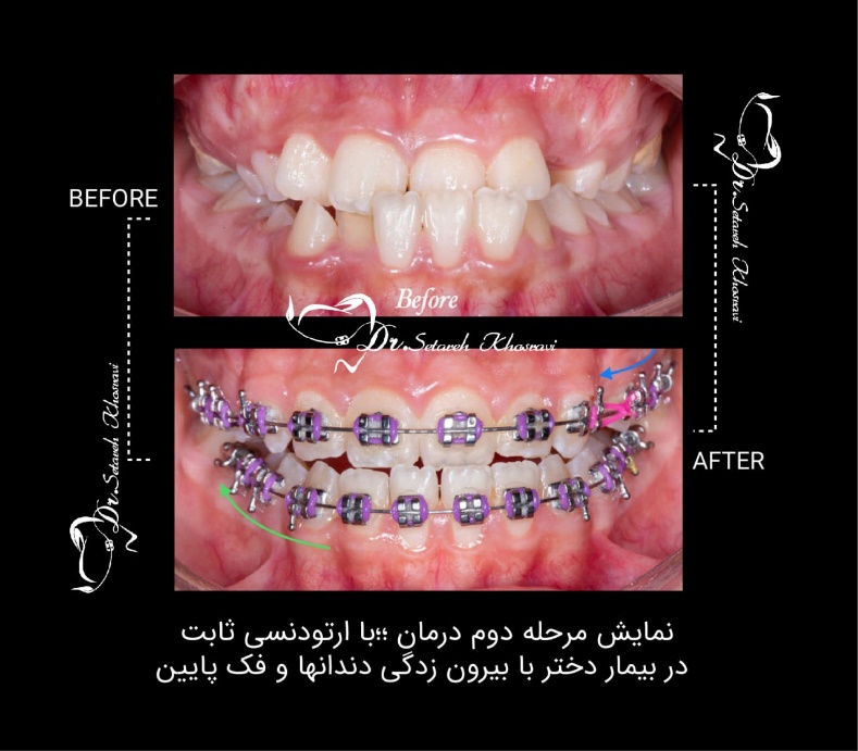 دکتر ارتودنسی خوب در تهران