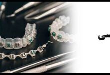  مقایسه سیم های NiTi و استیل در ارتودنسی