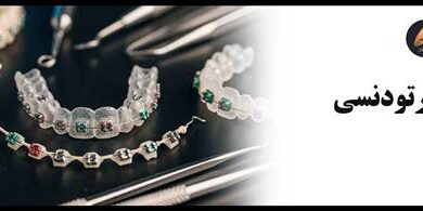 مقایسه سیم های NiTi و استیل در ارتودنسی