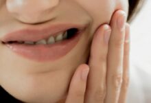 شایع‌ترین بیماری‌های دهان و دندان چیست؟