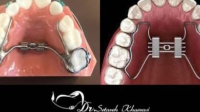 بزرگ کننده فک