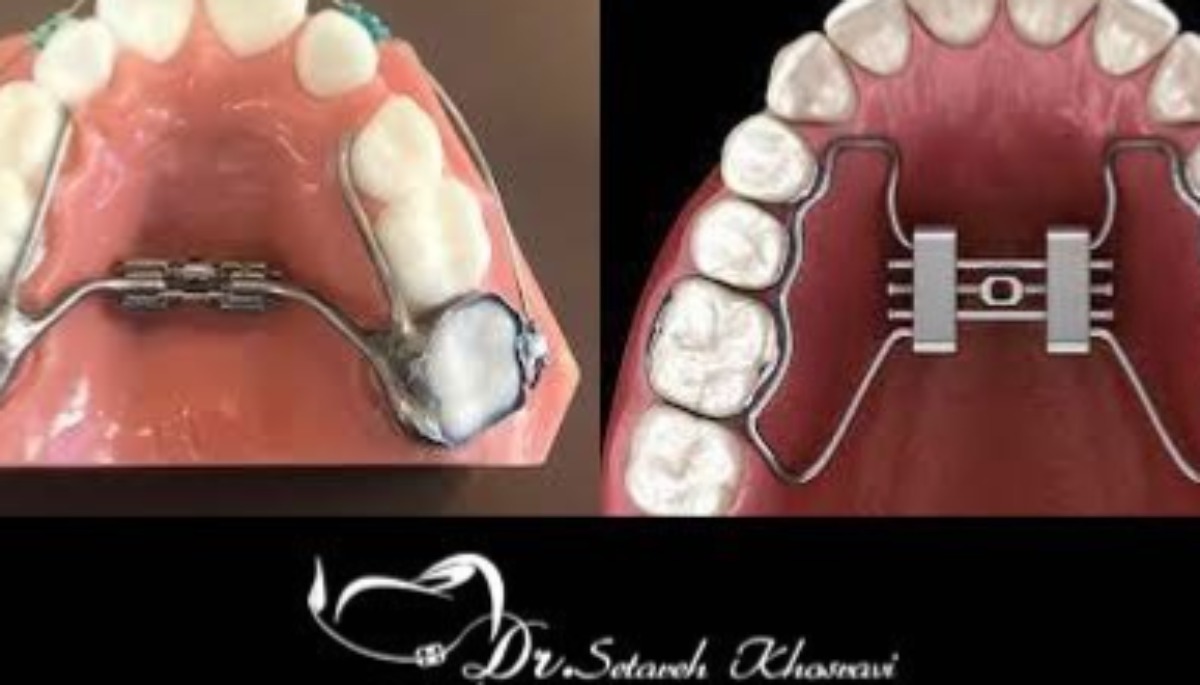 بزرگ کننده فک