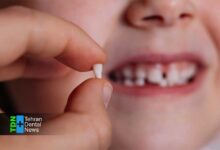 تغذیه مناسب برای سلامت دندان شیری کودک چگونه پوسیدگی زودرس را متوقف می کند