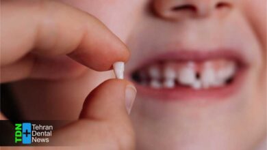 تغذیه مناسب برای سلامت دندان شیری کودک چگونه پوسیدگی زودرس را متوقف می کند