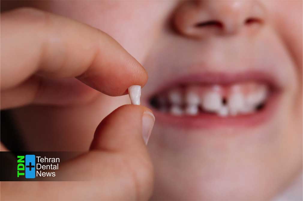 تغذیه مناسب برای سلامت دندان شیری کودک چگونه پوسیدگی زودرس را متوقف می کند