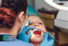 فلوراید برای کودکان چگونه از پوسیدگی دندان جلوگیری می کند و چه زمانی ضروری است