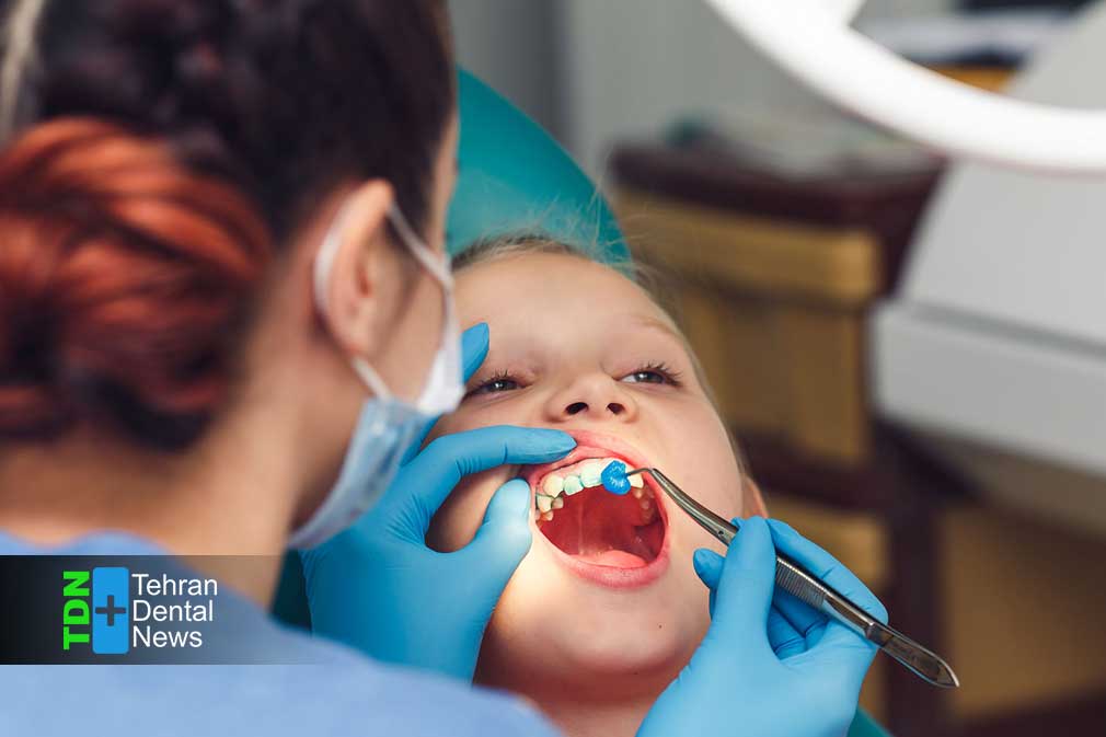 فلوراید برای کودکان چگونه از پوسیدگی دندان جلوگیری می کند و چه زمانی ضروری است