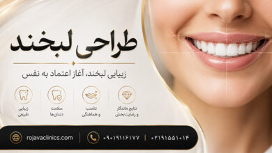 طراحی لبخند چیست؟ روش های اصطلاح طرح لبخند + مزایا و معایب