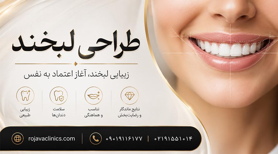 طراحی لبخند چیست؟ روش های اصطلاح طرح لبخند + مزایا و معایب