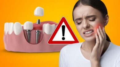 دلایل ضعف بعد از ایمپلنت دندان و یک رژیم غذایی برای پیشگیری!