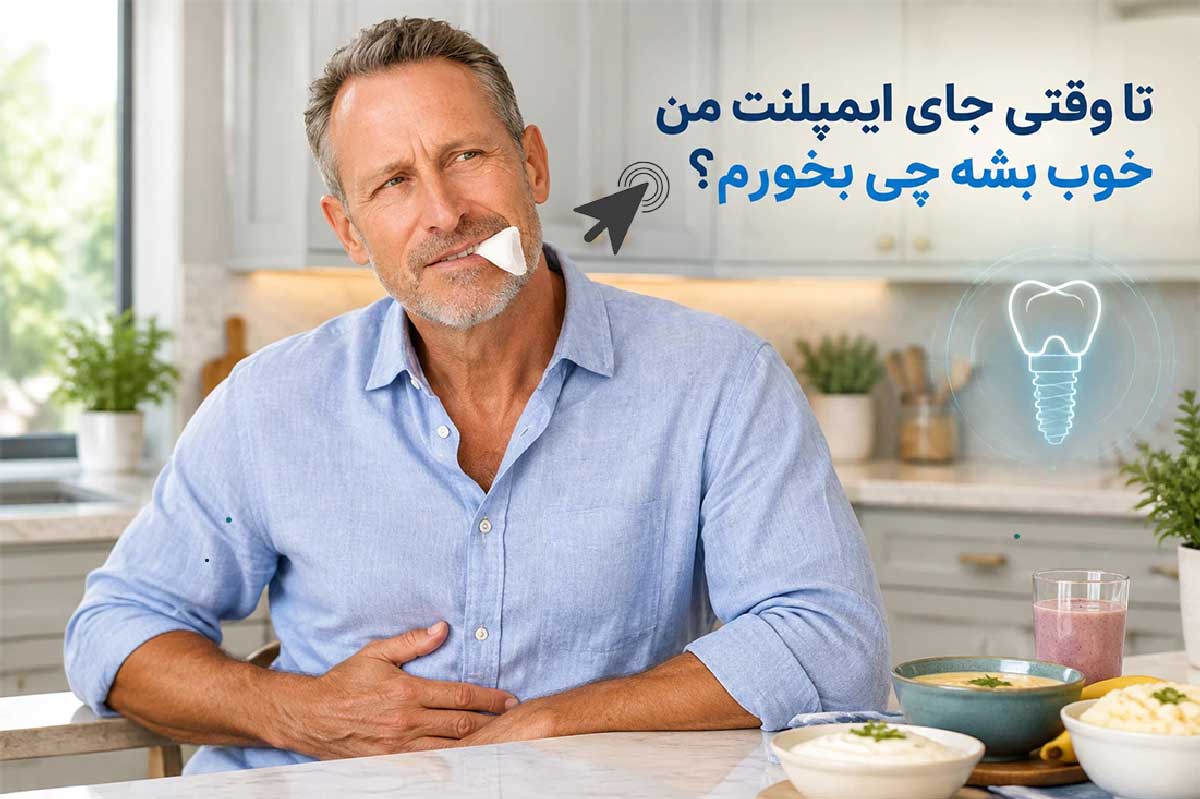 گاز استریل هنگام غذا خوردن بعد ایمپلنت