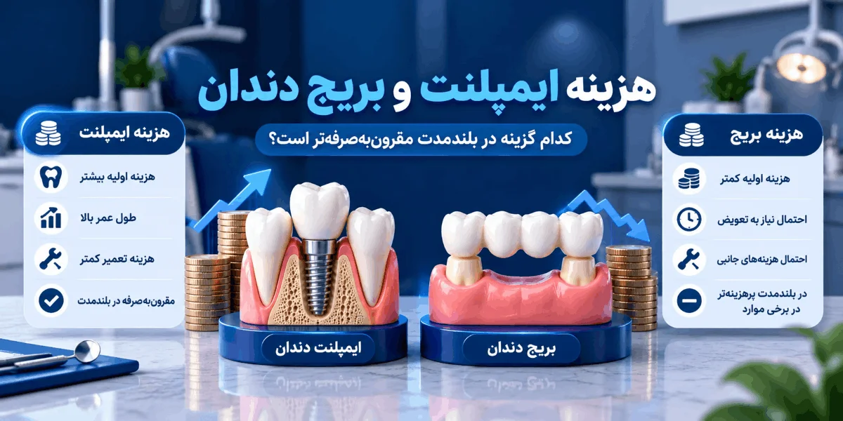 مقایسه هزینه ایمپلنت و بریج دندان در کوتاهمدت و بلندمدت