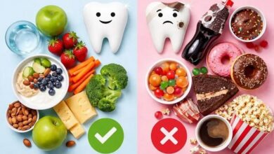 مراقبت و رژیم غذایی بعد از لمینت دندانها